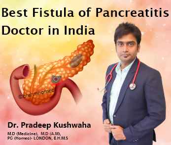 Fistula Pancreatitis Treatment | Pancreatic Fistula Treatment