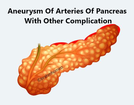 aneurysm-of-arteries-of-pancreas-with-otherp-complication