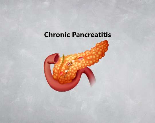 Chronic pancreatitis treatment