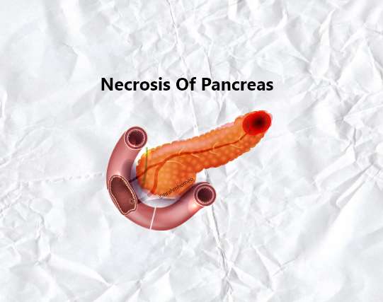 Necrosis Of Pancrease